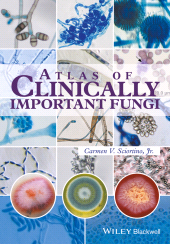 E-book, Atlas of Clinically Important Fungi, Wiley