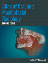 E-book, Atlas of Oral and Maxillofacial Radiology, Wiley
