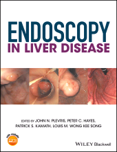 E-book, Endoscopy in Liver Disease, Wiley