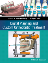 E-book, Digital Planning and Custom Orthodontic Treatment, Wiley