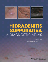 E-book, Hidradenitis Suppurativa : A Diagnostic Atlas, Wiley