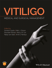 eBook, Vitiligo : Medical and Surgical Management, Blackwell
