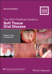 E-book, The ADA Practical Guide to Soft Tissue Oral Disease, Blackwell