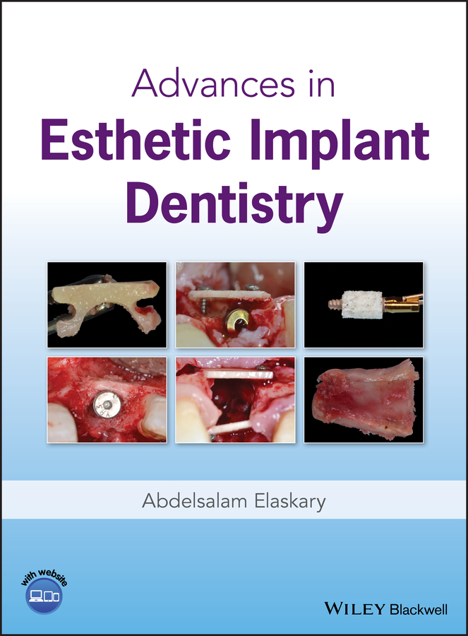 E-book, Advances in Esthetic Implant Dentistry, Blackwell