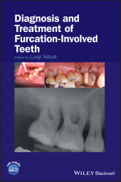 E-book, Diagnosis and Treatment of Furcation-Involved Teeth, Blackwell