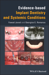 E-book, Evidence-based Implant Dentistry and Systemic Conditions, Blackwell