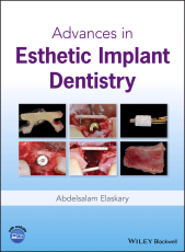 E-book, Advances in Esthetic Implant Dentistry, Wiley