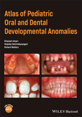 E-book, Atlas of Pediatric Oral and Dental Developmental Anomalies, Wiley