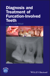 E-book, Diagnosis and Treatment of Furcation-Involved Teeth, Wiley