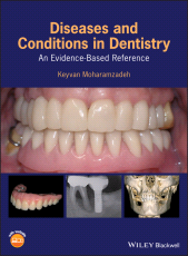 E-book, Diseases and Conditions in Dentistry : An Evidence-Based Reference, Wiley