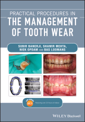 eBook, Practical Procedures in the Management of Tooth Wear, Blackwell