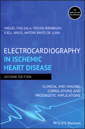 eBook, Electrocardiography in Ischemic Heart Disease : Clinical and Imaging Correlations and Prognostic Implications, Blackwell