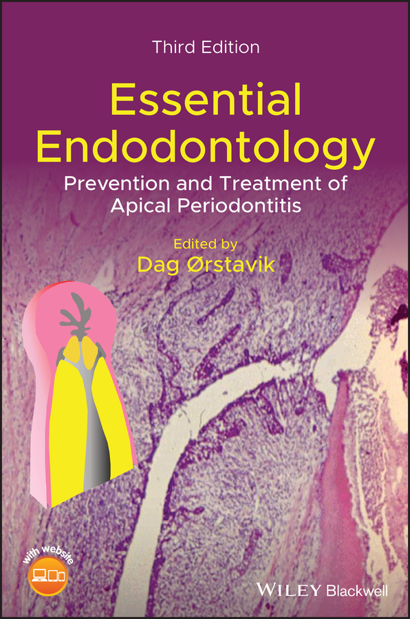 E-book, Essential Endodontology : Prevention and Treatment of Apical Periodontitis, Blackwell