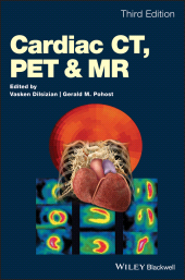 E-book, Cardiac CT, PET and MR, Blackwell