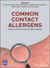 E-book, Common Contact Allergens : A Practical Guide to Detecting Contact Dermatitis, Blackwell