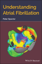 eBook, Understanding Atrial Fibrillation, Blackwell