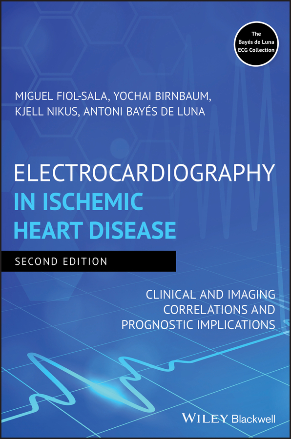 eBook, Electrocardiography in Ischemic Heart Disease : Clinical and Imaging Correlations and Prognostic Implications, Blackwell