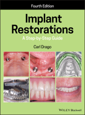 E-book, Implant Restorations : A Step-by-Step Guide, Blackwell