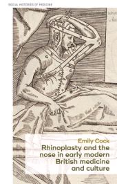 E-book, Rhinoplasty and the nose in early modern British medicine and culture, Manchester University Press
