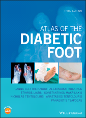 E-book, Atlas of the Diabetic Foot, Eleftheriadou, Ioanna, Wiley