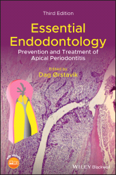 E-book, Essential Endodontology : Prevention and Treatment of Apical Periodontitis, Wiley