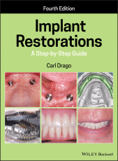 E-book, Implant Restorations : A Step-by-Step Guide, Wiley