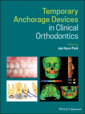 eBook, Temporary Anchorage Devices in Clinical Orthodontics, Blackwell