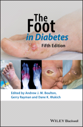 E-book, The Foot in Diabetes, Blackwell