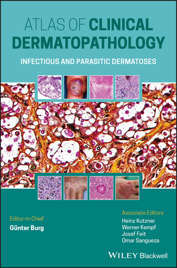 eBook, Atlas of Clinical Dermatopathology : Infectious and Parasitic Dermatoses, Blackwell