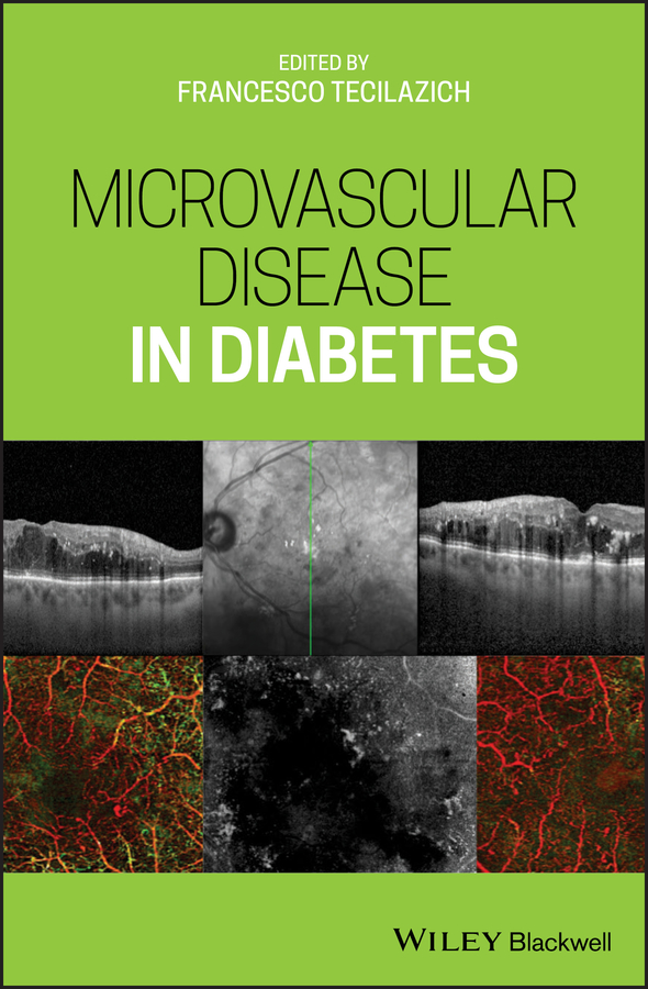 eBook, Microvascular Disease in Diabetes, Blackwell