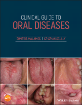 E-book, Clinical Guide to Oral Diseases, Blackwell