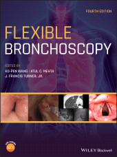 E-book, Flexible Bronchoscopy, Blackwell