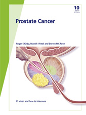 E-book, Fast Facts : Prostate Cancer : If, when and how to intervene, Karger Publishers