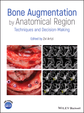 eBook, Bone Augmentation by Anatomical Region : Techniques and Decision-Making, Wiley