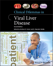 E-book, Clinical Dilemmas in Viral Liver Disease, Wiley