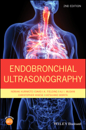 eBook, Endobronchial Ultrasonography, Wiley