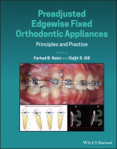 E-book, Preadjusted Edgewise Fixed Orthodontic Appliances : Principles and Practice, Blackwell