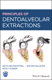 eBook, Principles of Dentoalveolar Extractions, Blackwell