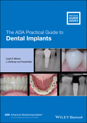 E-book, The ADA Practical Guide to Dental Implants, Blackwell