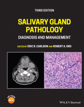 E-book, Salivary Gland Pathology : Diagnosis and Management, Blackwell