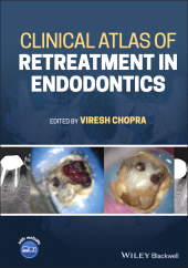 E-book, Clinical Atlas of Retreatment in Endodontics, Blackwell