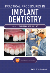 E-book, Practical Procedures in Implant Dentistry, Blackwell
