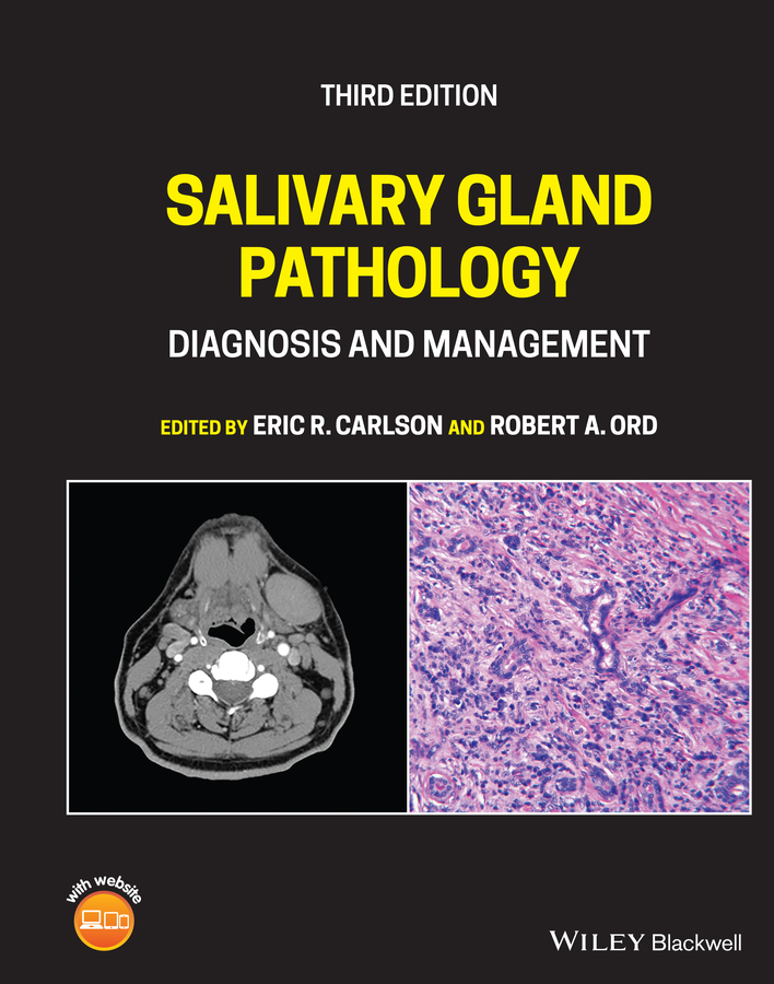 E-book, Salivary Gland Pathology : Diagnosis and Management, Blackwell