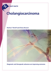 E-book, Fast Facts : Cholangiocarcinoma : Diagnostic and therapeutic advances are improving outcomes, Karger Publishers