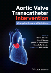 E-book, Aortic Valve Transcatheter Intervention : Complications and Solutions, Wiley