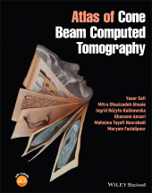E-book, Atlas of Cone Beam Computed Tomography, Safi, Yaser, Wiley