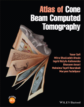 eBook, Atlas of Cone Beam Computed Tomography, Wiley