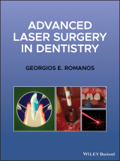 E-book, Advanced Laser Surgery in Dentistry, Romanos, Georgios E., Wiley