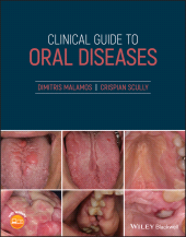 E-book, Clinical Guide to Oral Diseases, Malamos, Dimitris, Wiley