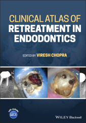 eBook, Clinical Atlas of Retreatment in Endodontics, Wiley